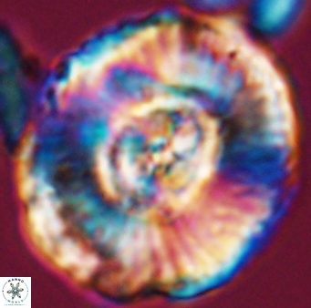 Watznaueria moshkovitzii 11008