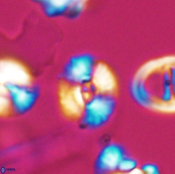 Watznaueria okadai 9483