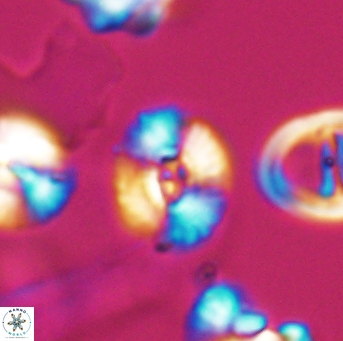 Watznaueria okadai 9483