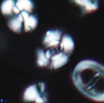 Watznaueria okadai 9486