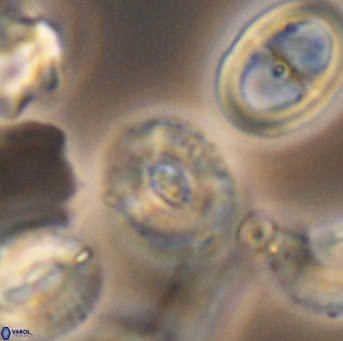 Watznaueria okadai 9489