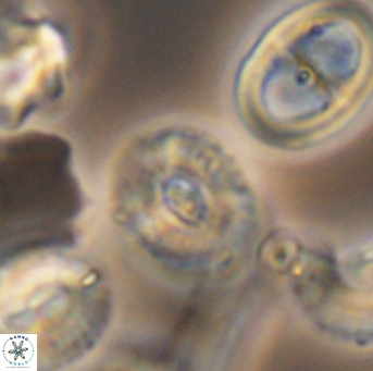 Watznaueria okadai 9489