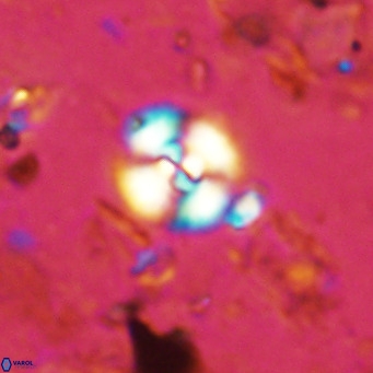 Watznaueria paenepelagicus 13496