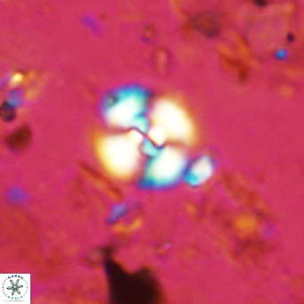 Watznaueria paenepelagicus 13496