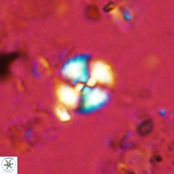 Watznaueria paenepelagicus 13503