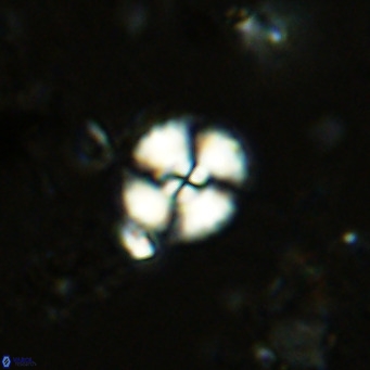 Watznaueria paenepelagicus 13504