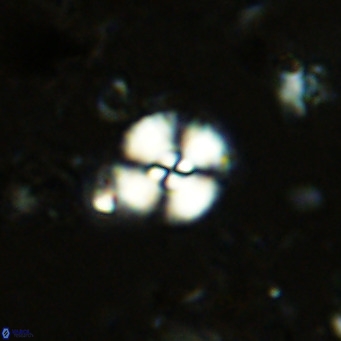 Watznaueria paenepelagicus 13505