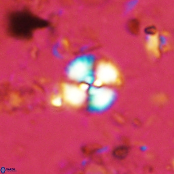 Watznaueria paenepelagicus 13506