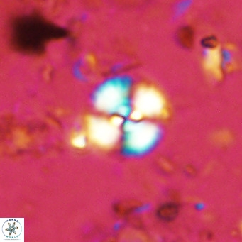 Watznaueria paenepelagicus 13506