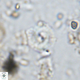 Watznaueria paenepelagicus 13510