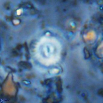 Watznaueria paenepelagicus 13514