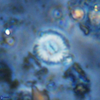 Watznaueria paenepelagicus 13515
