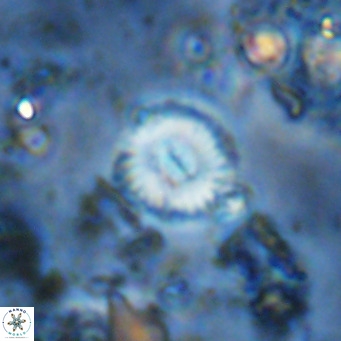 Watznaueria paenepelagicus 13515