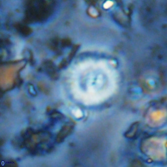 Watznaueria paenepelagicus 13516