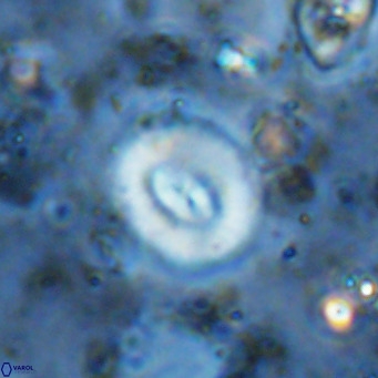 Watznaueria paenepelagicus VR 15268