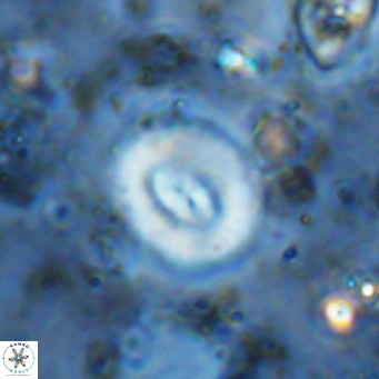 Watznaueria paenepelagicus VR 15268
