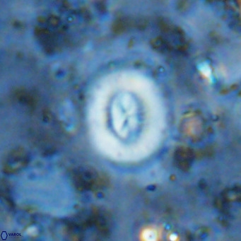 Watznaueria paenepelagicus VR 15269