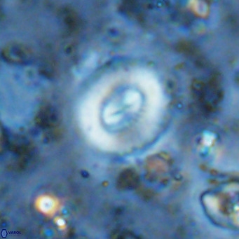 Watznaueria paenepelagicus VR 15270