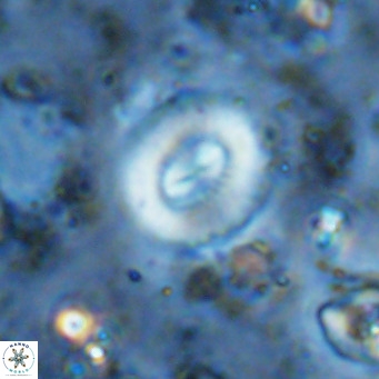 Watznaueria paenepelagicus VR 15270