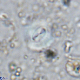 Watznaueria paenepelagicus VR 15274