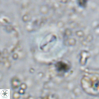Watznaueria paenepelagicus VR 15274