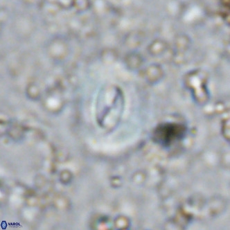 Watznaueria paenepelagicus VR 15275