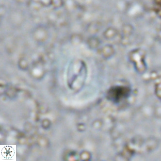 Watznaueria paenepelagicus VR 15275