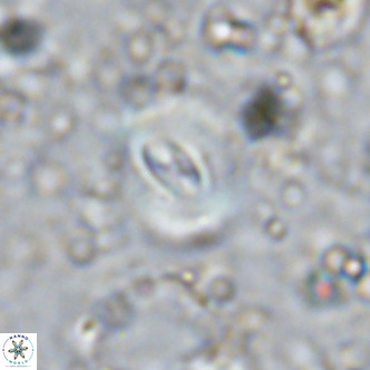 Watznaueria paenepelagicus VR 15276