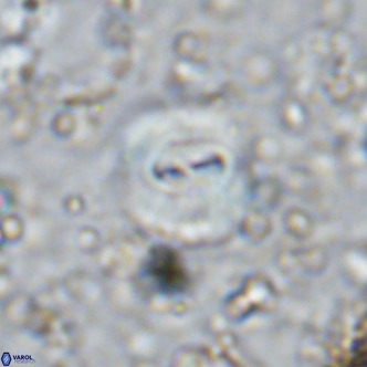Watznaueria paenepelagicus VR 15277