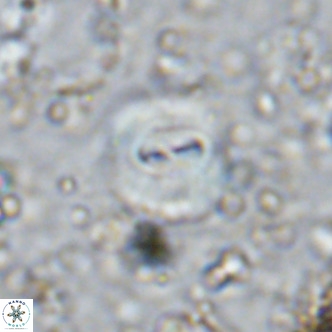 Watznaueria paenepelagicus VR 15277