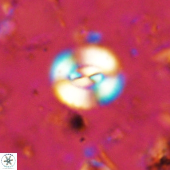 Watznaueria paenepelagicus VR 15278