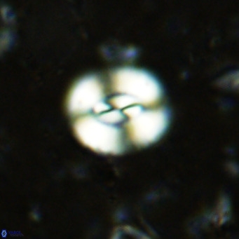 Watznaueria paenepelagicus VR 15281