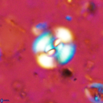 Watznaueria paenepelagicus VR 15283