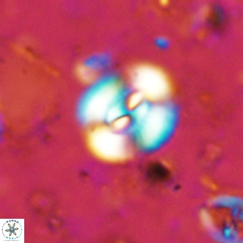 Watznaueria paenepelagicus VR 15283