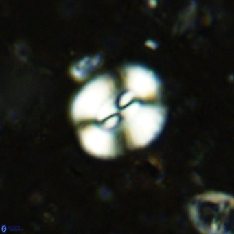 Watznaueria paenepelagicus VR 15285