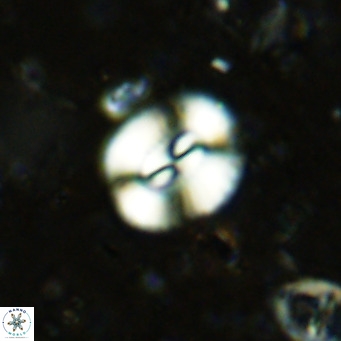 Watznaueria paenepelagicus VR 15285
