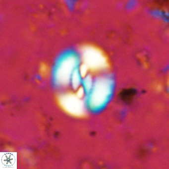 Watznaueria paenepelagicus VR 15287