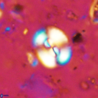 Watznaueria paenepelagicus VR 15292