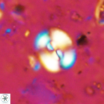 Watznaueria paenepelagicus VR 15292