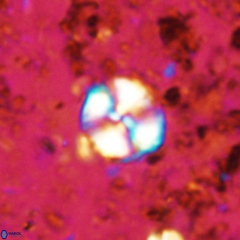Watznaueria paenepelagicus VR 20195