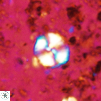 Watznaueria paenepelagicus VR 20195