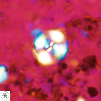 Watznaueria paenepelagicus VR 20199
