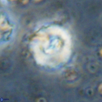 Watznaueria paenepelagicus VR 20254
