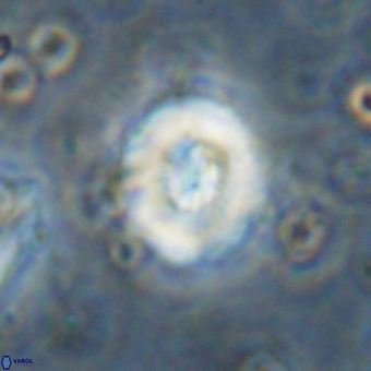 Watznaueria paenepelagicus VR 20257