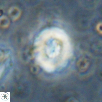 Watznaueria paenepelagicus VR 20257