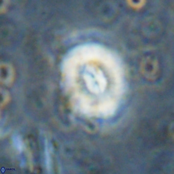 Watznaueria paenepelagicus VR 20258