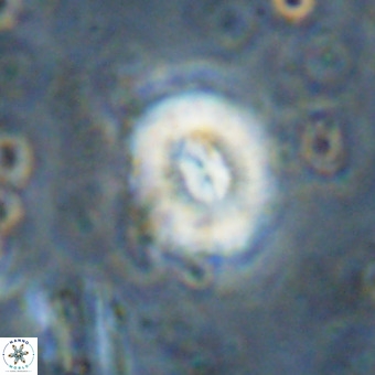 Watznaueria paenepelagicus VR 20258