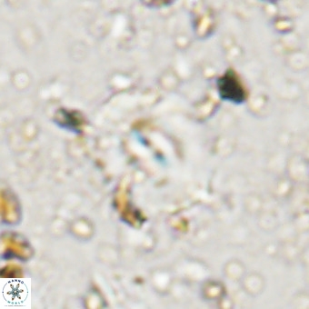 Watznaueria paenepelagicus VR 20261