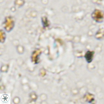 Watznaueria paenepelagicus VR 20262
