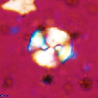 Watznaueria paenepelagicus VR 20265